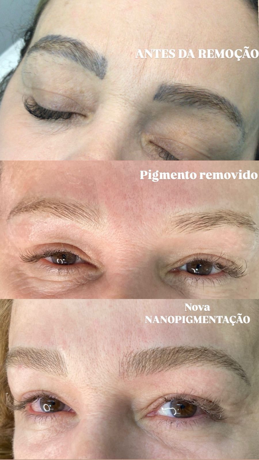 Antes e depois Belfort Beauty 1