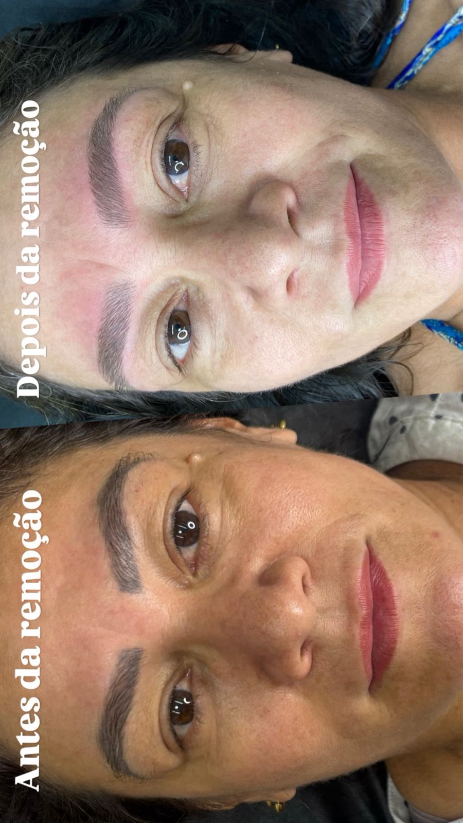 Antes e depois Belfort Beauty 3