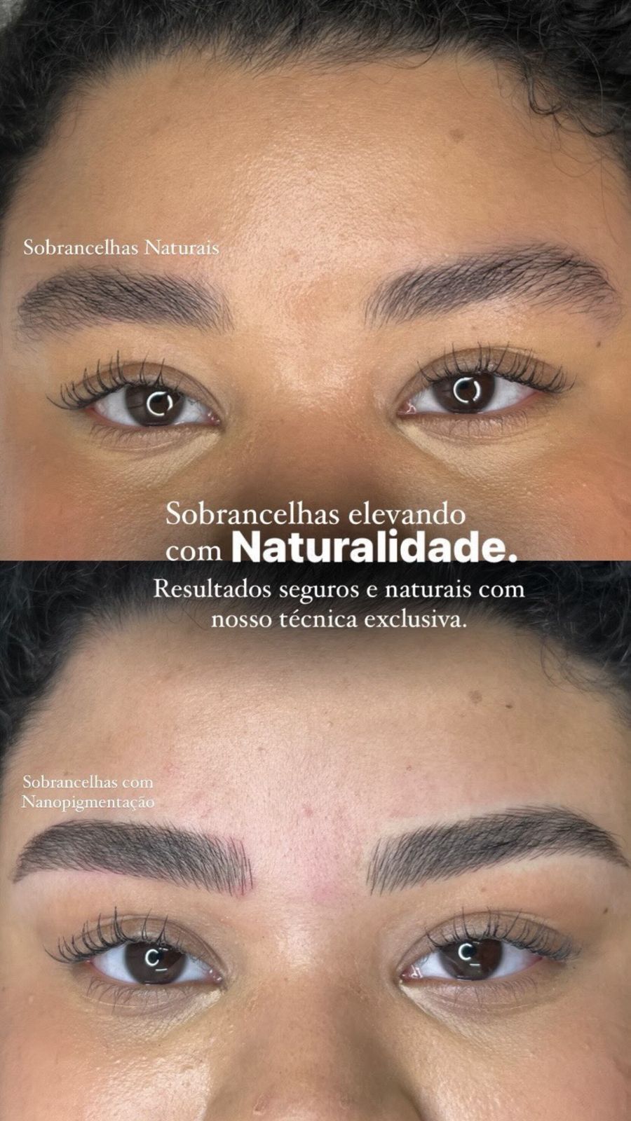 Antes e depois Belfort Beauty 4