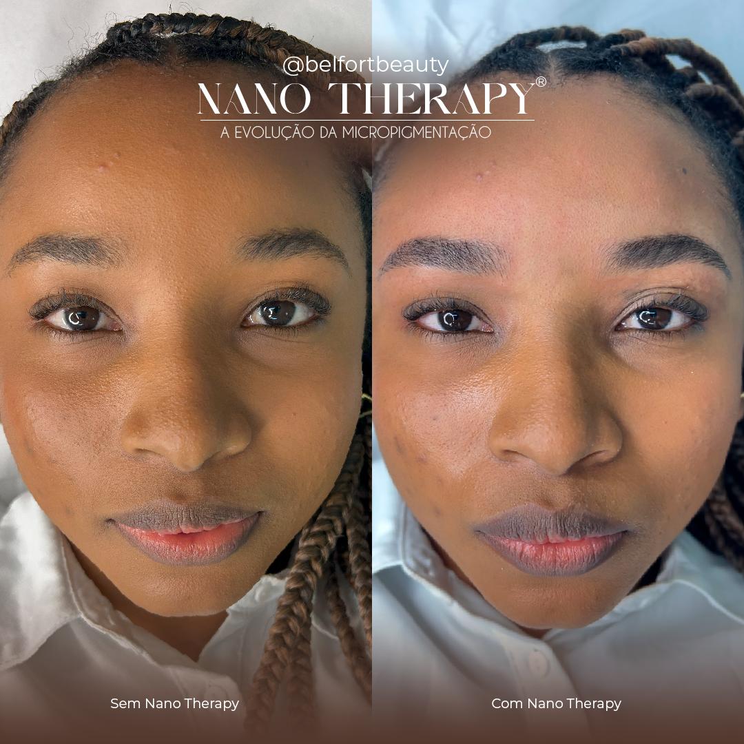 Resultado de Nano Therapy
